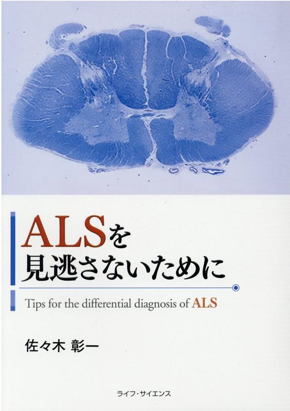 楽天ブックス Alsを見逃さないために 佐々木彰一 本