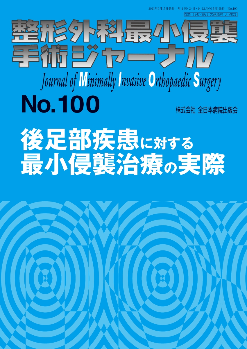 楽天ブックス: 後足部疾患に対する最小侵襲治療の実際（2021年9月号No