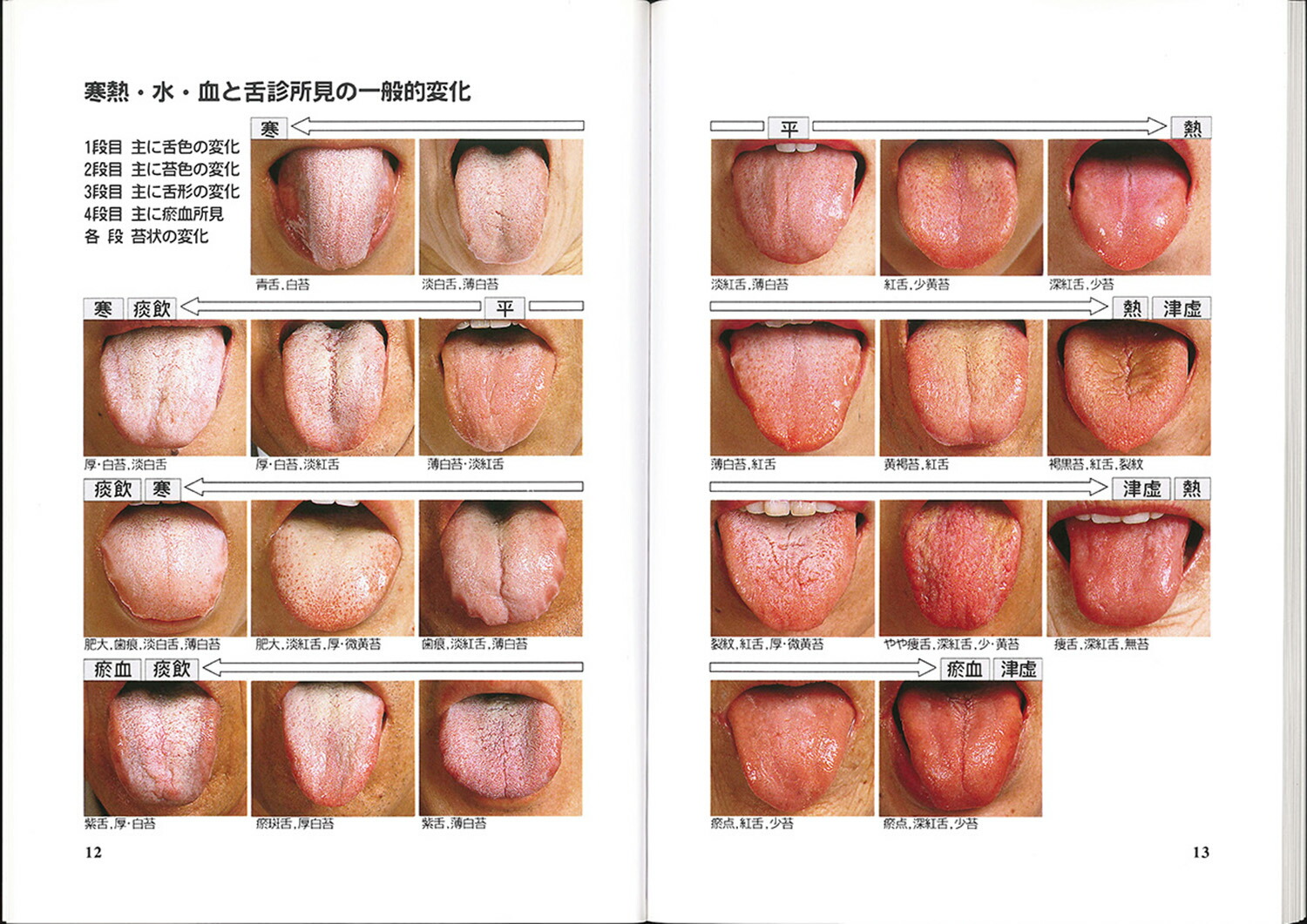 楽天ブックス 舌診アトラス手帳 松本 克彦 本