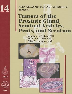 楽天ブックス: Tumors of the Prostate Gland, Seminal Vesicles