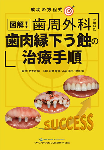 楽天市場】歯科衛生士の力でここまでできる非外科的歯周治療