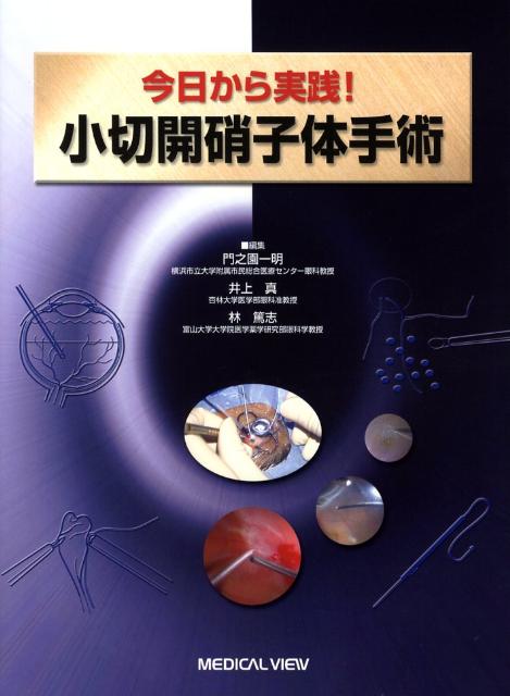 今日から実践！小切開硝子体手術