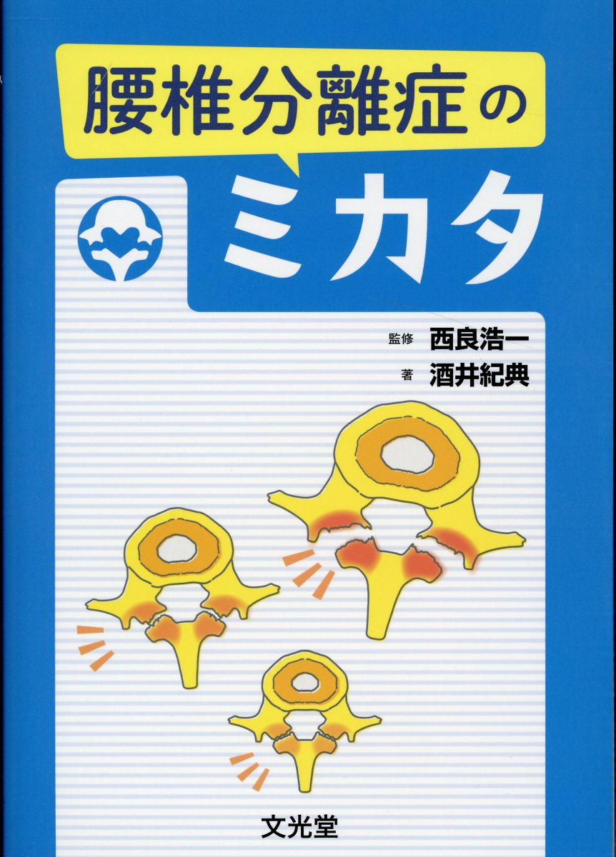 楽天ブックス: 腰椎分離症のミカタ - 西良浩一 - 9784830627392 : 本