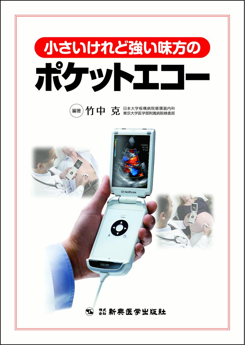 楽天ブックス: 小さいけれど強い味方のポケットエコー - 竹中 克