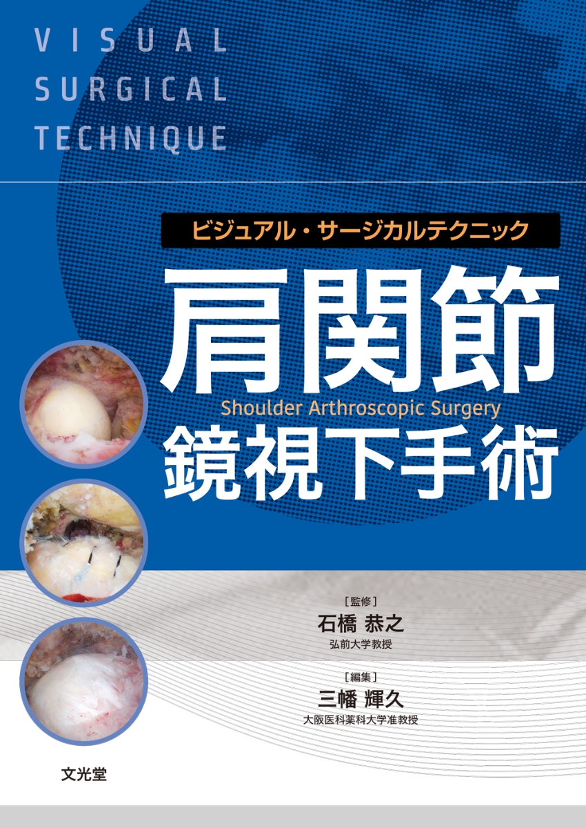 肩関節鏡視下手術 ビジュアル・サージカルテクニック 石橋恭之 - 医学