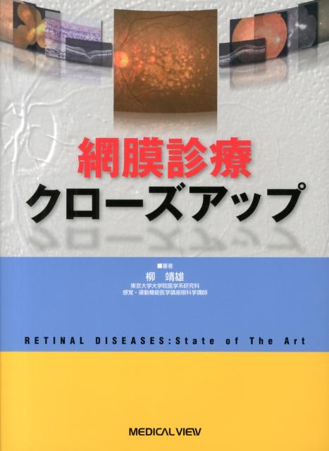 楽天ブックス: 網膜診療クローズアップ - 柳靖雄 - 9784758307475 : 本