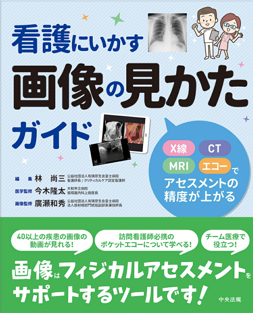 看護にいかす画像の見かたガイドX線・CT・MRI・エコーでアセスメントの精度が上がる[林尚三]