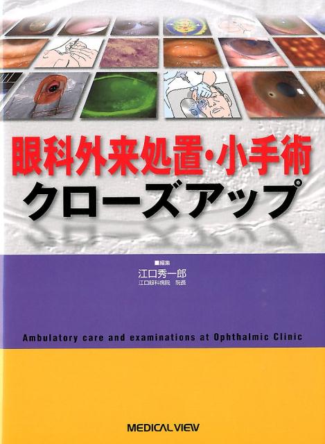 楽天ブックス: 眼科外来処置・小手術クローズアップ - 江口秀一郎