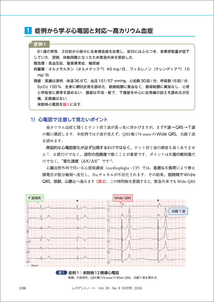 レジデントノート2026年9月号[水上暁]