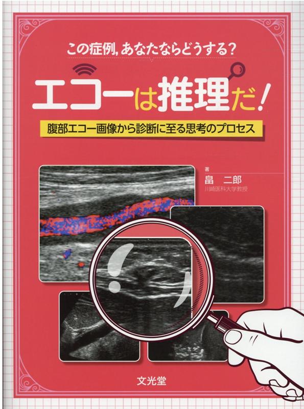 エコーは推理だ! 腹部エコー画像から診断に至る思考のプロセス