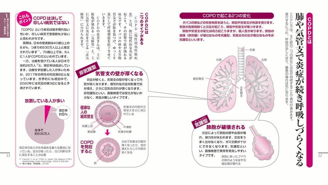 楽天ブックス Copdのことがよくわかる本 長引くせき たん 息切れで悩む人に 桂 秀樹 本