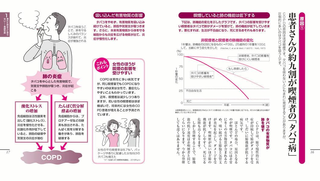 楽天ブックス Copdのことがよくわかる本 長引くせき たん 息切れで悩む人に 桂 秀樹 本
