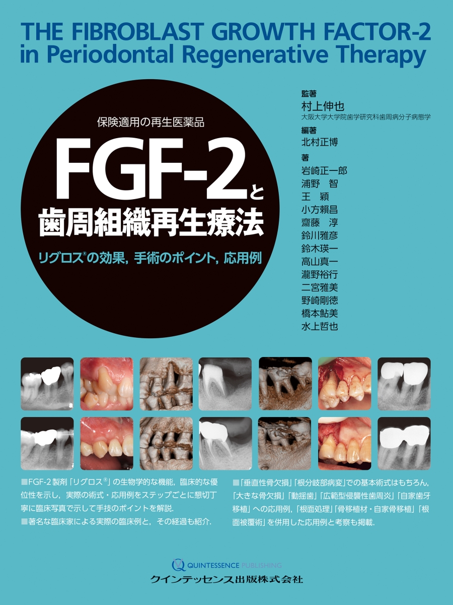 楽天ブックス: FGF-2と歯周組織再生療法 - リグロスの効果，手術の