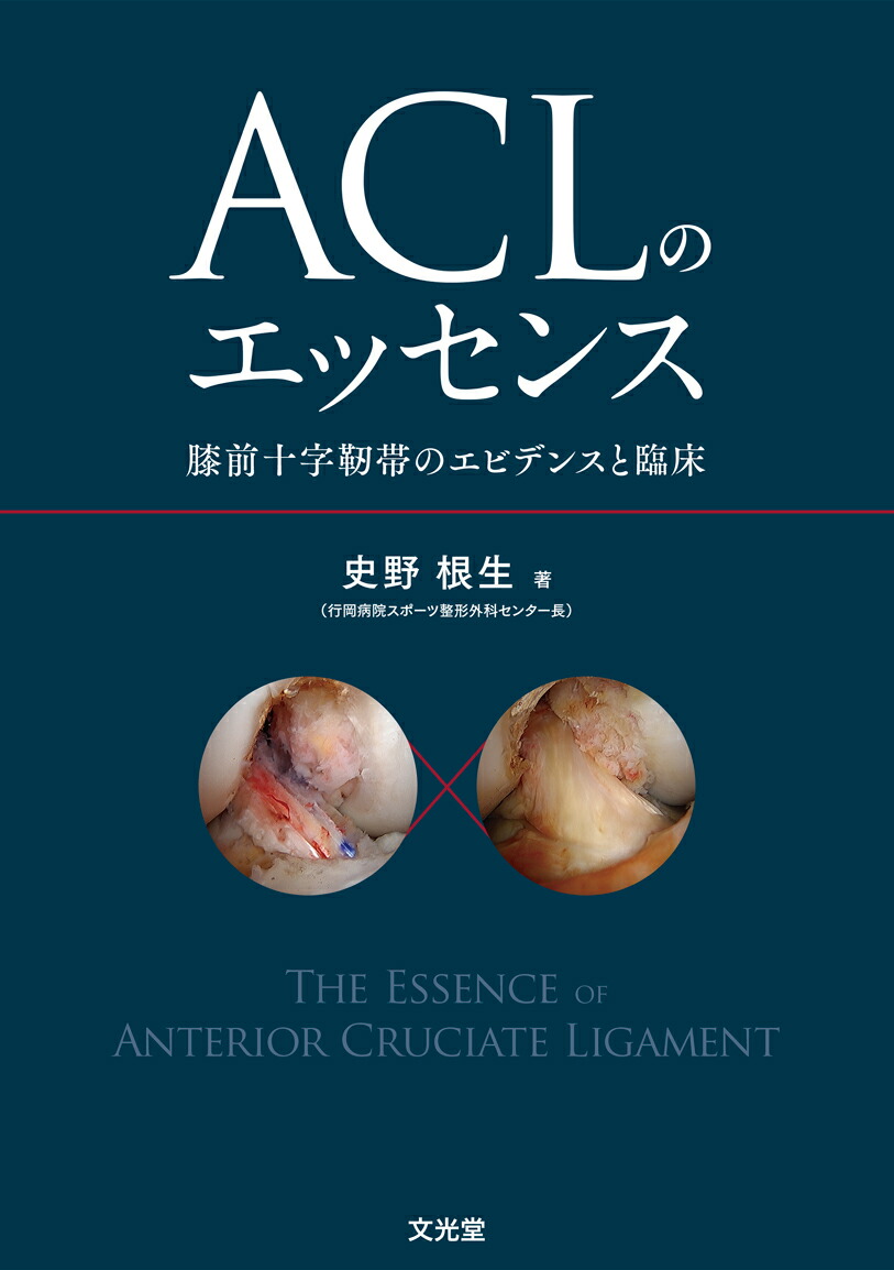 パーフェクト 前十字靭帯再建術 (ACL) パーフェクト 前十字靭帯再建術(ACL) | 石橋 恭之, 黒田 良祐