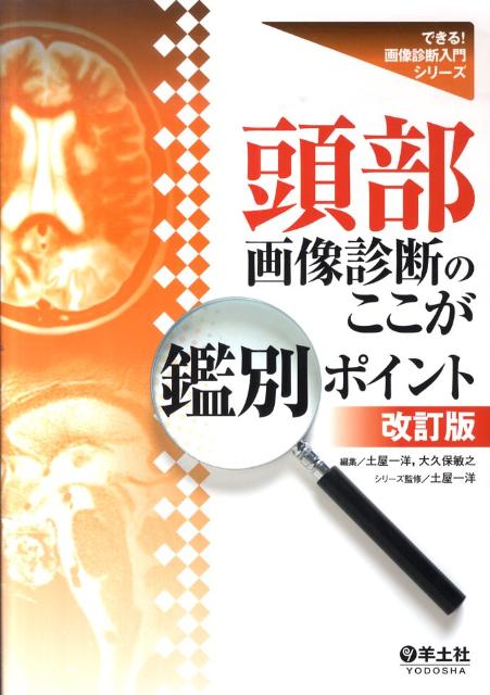 楽天ブックス: 頭部画像診断のここが鑑別ポイント改訂版 - 土屋