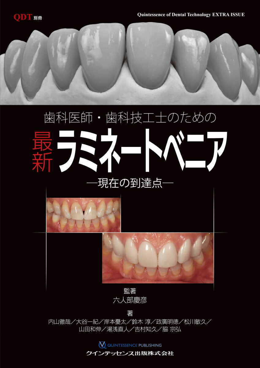 楽天ブックス: 歯科医師・歯科技工士のための最新ラミネートベニア