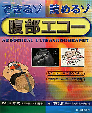 できるゾ 読めるゾ 腹部エコー できるゾ読めるゾ腹部エコ－ / 朝井 均【監修】/中村 滋【著