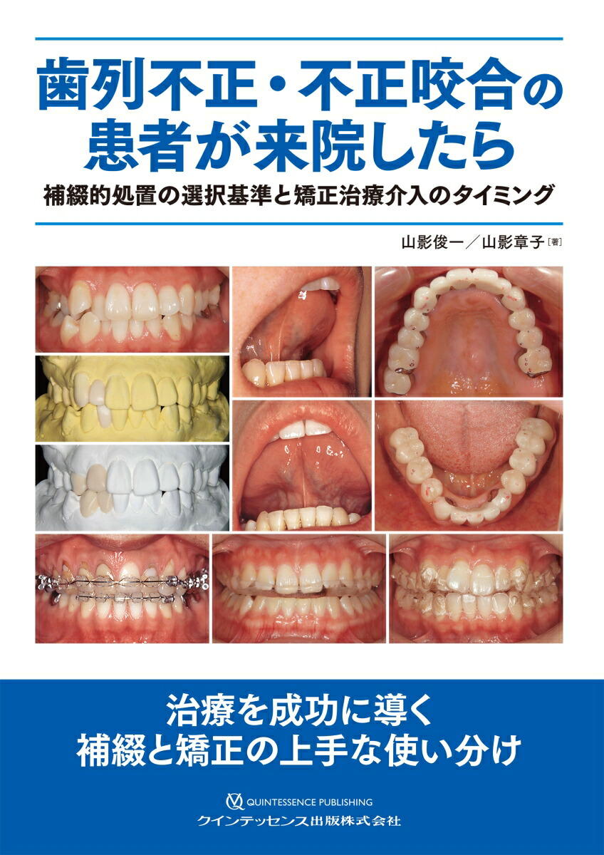 ホームドクターによる小学校2年生までに始める拡大床治療／須貝昭弘 