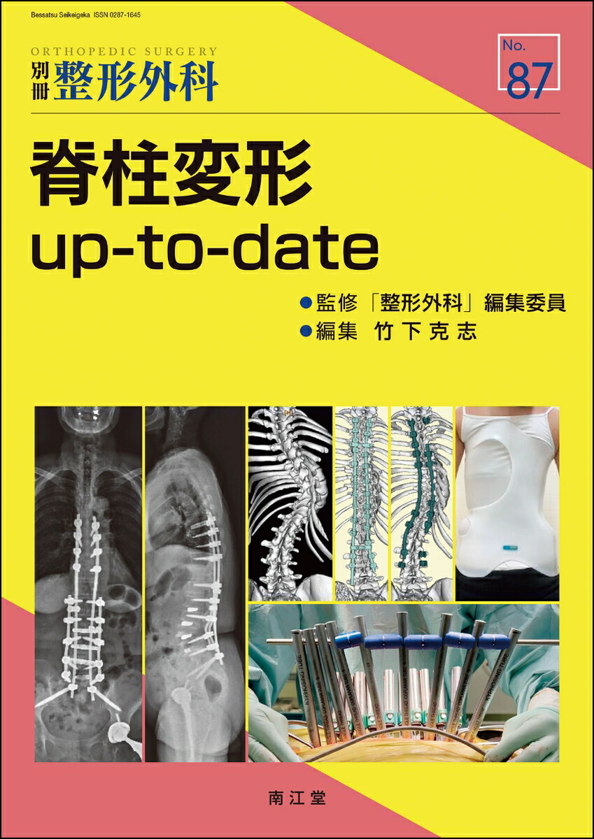 全ての - up-to-date 脊柱変形 楽天ブックス: 竹下克志 9784524277872 - 医学一般