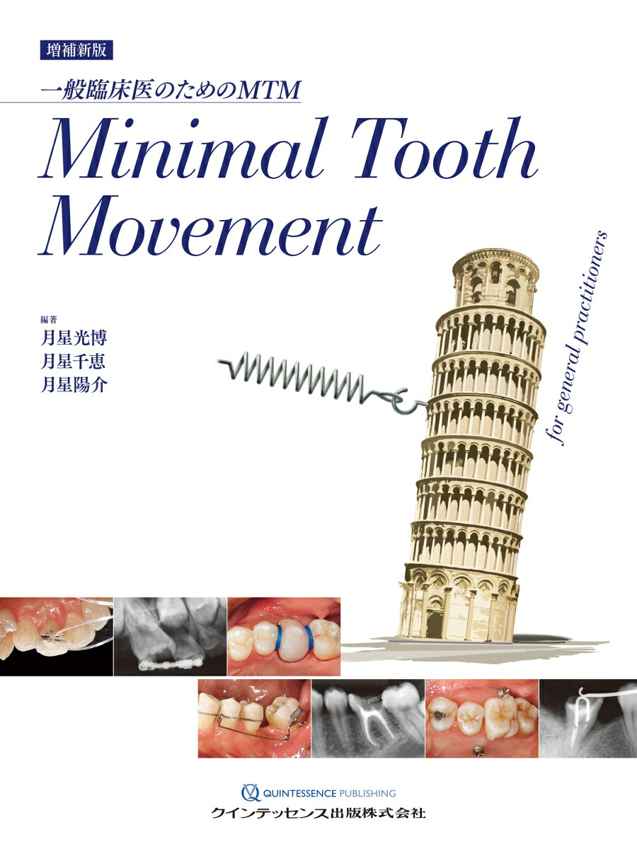 楽天ブックス: 増補新版 Minimal Tooth Movement - 一般臨床医のための