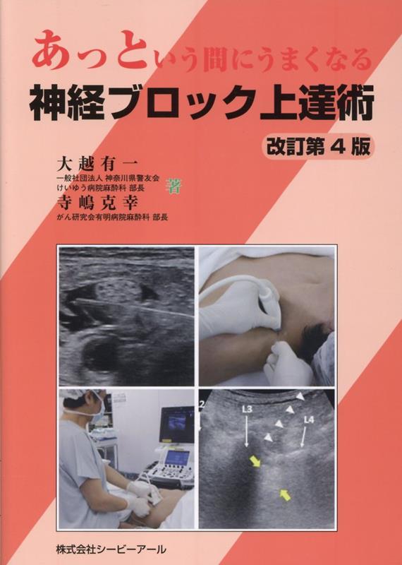 腕神経叢ブロック (臨床雑誌整形外科 66巻8号) | 医書.jp