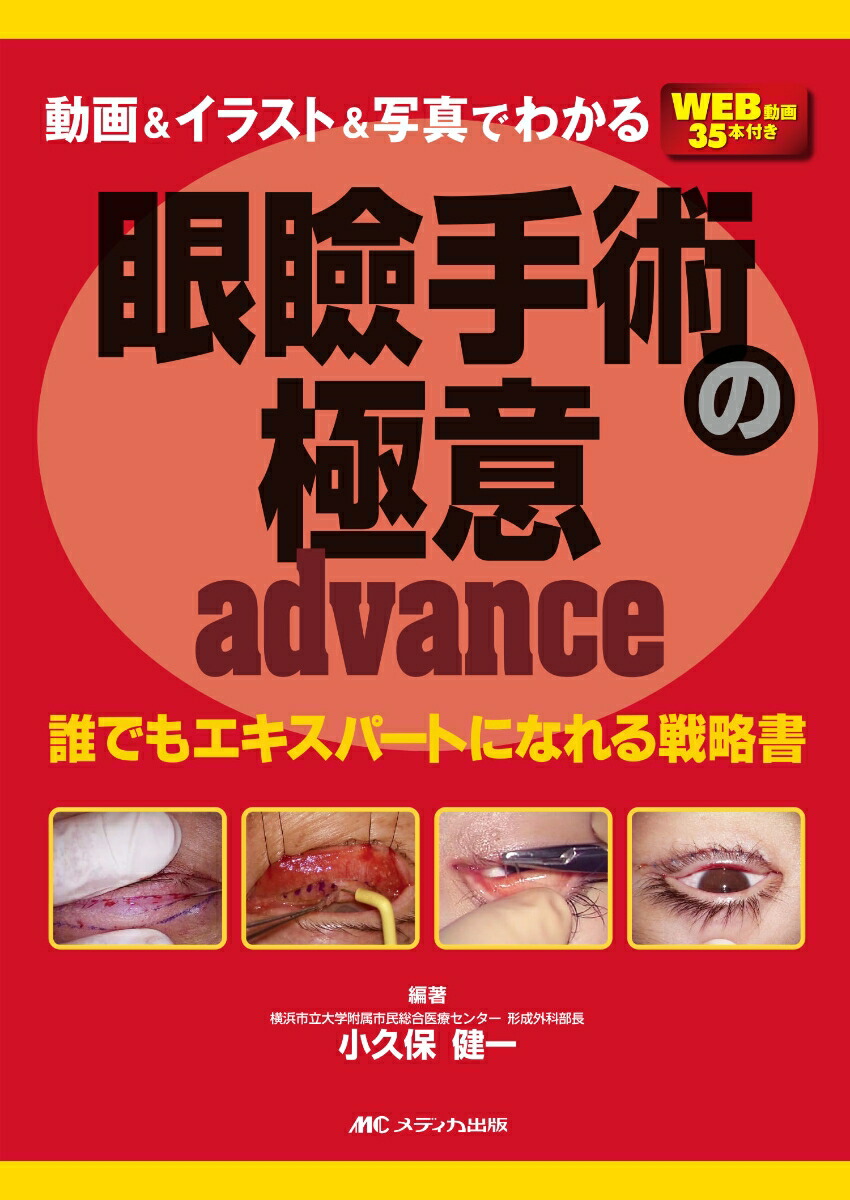 動画＆イラスト＆写真でわかる眼瞼手術の極意 advance