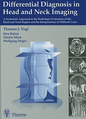 楽天ブックス: Differential Diagnosis in Head and Neck