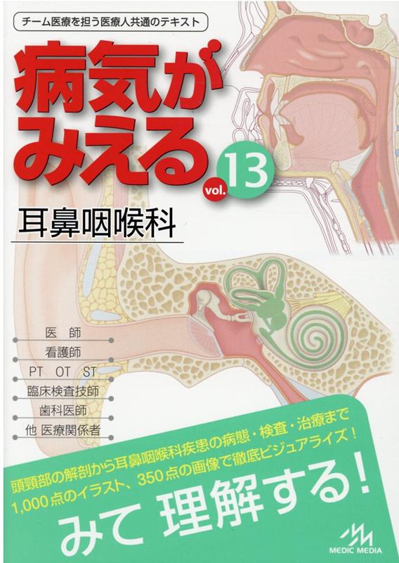 楽天ブックス: 病気がみえる（vol.13） - 耳鼻咽喉科 - 医療情報科学