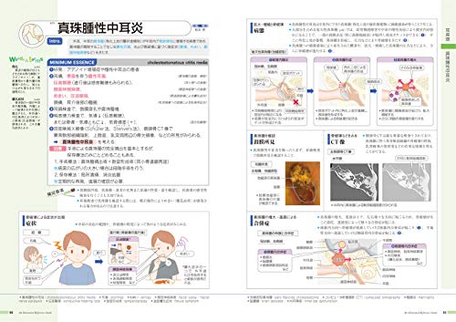 病気がみえる（vol.13）耳鼻咽喉科[医療情報科学研究所]