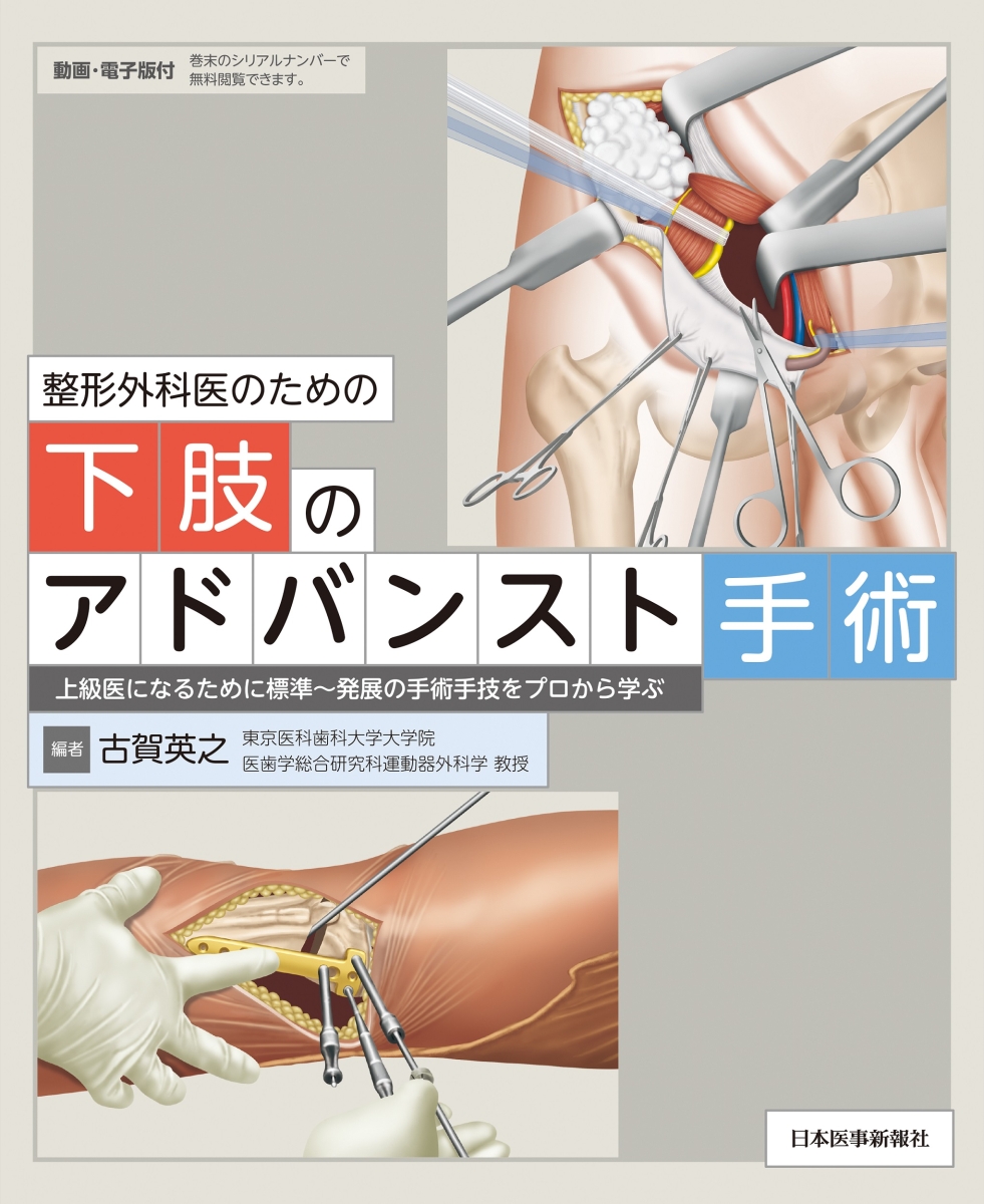 楽天ブックス: 整形外科医のための下肢のアドバンスト手術 - 古賀英之 