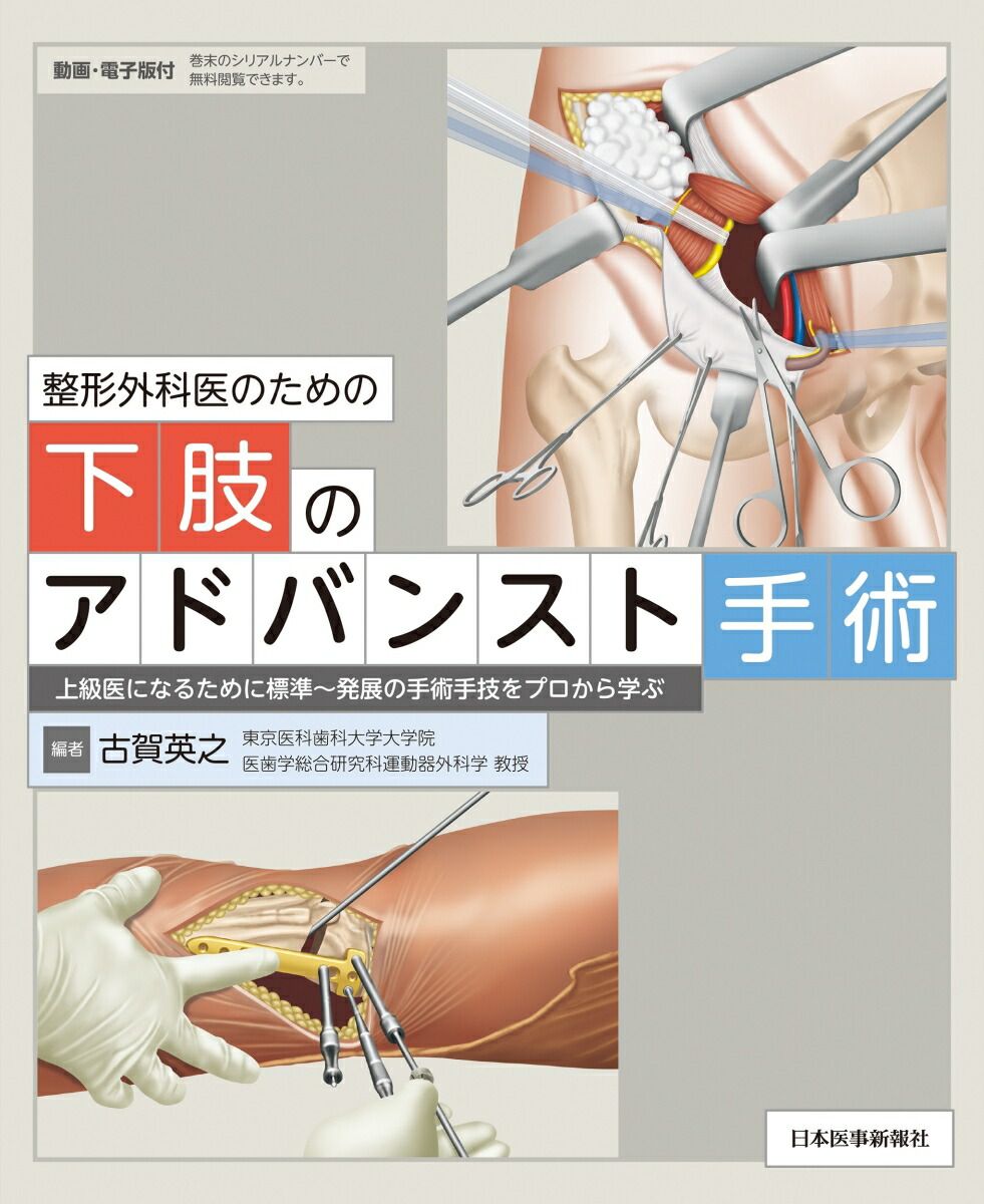 楽天ブックス: 整形外科医のための下肢のアドバンスト手術 - 古賀英之 