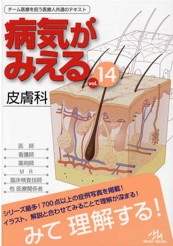 楽天ブックス: 病気がみえる（vol.14） - 皮膚科 - 医療情報科学研究所