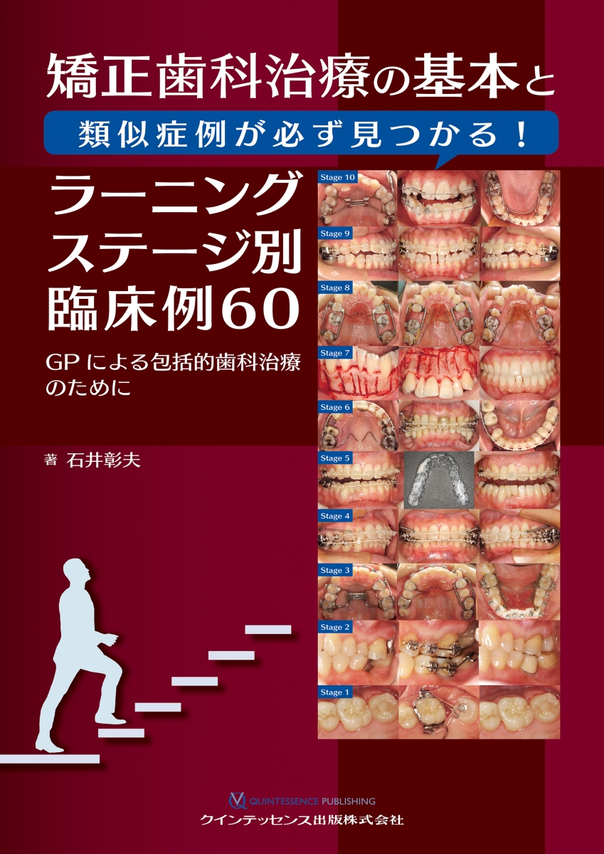 楽天ブックス: 矯正歯科治療の基本と類似症例が必ず見つかる