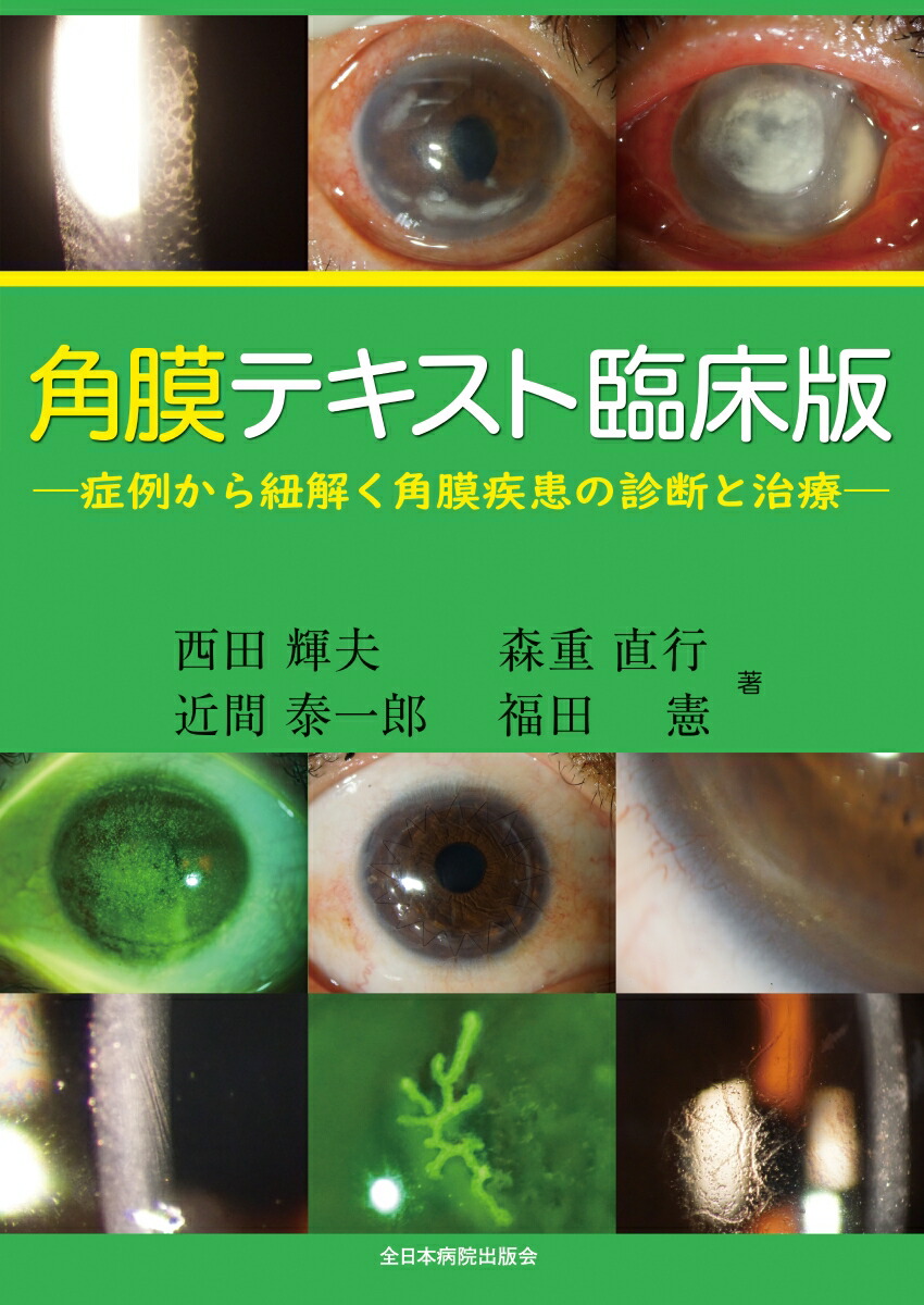 楽天ブックス: 角膜テキスト臨床版 - 症例から紐解く角膜疾患の診断と