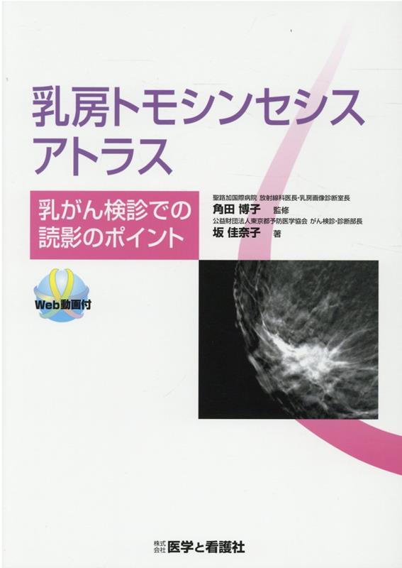 楽天ブックス: 乳房トモシンセシスアトラス 乳がん検診での読影