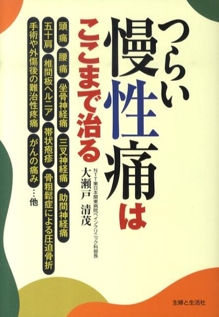 Amazon.co.jp: 透視下神経ブロック法 : 大瀬戸清茂: 本