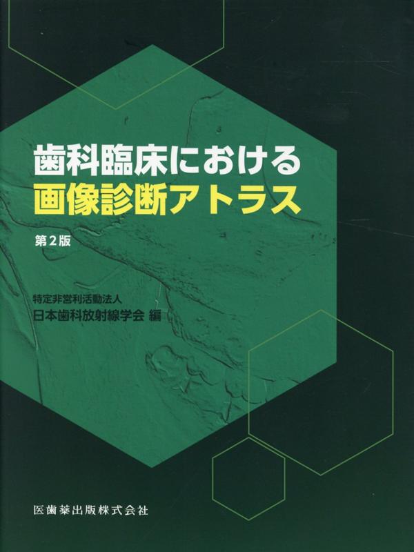 楽天ブックス: 歯科臨床における画像診断アトラス第2版 - 日本歯科