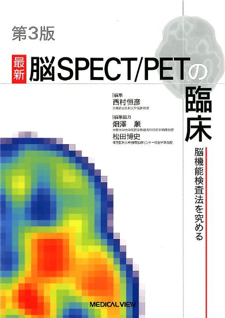 最新脳SPECT/PETの臨床 第2版: 脳機能の検査法 | 西村 恒彦 |本