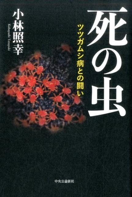 楽天ブックス 死の虫 ツツガムシ病との闘い 小林照幸 本