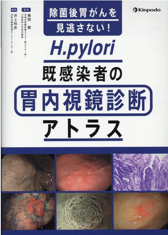 楽天ブックス 除菌後胃がんを見逃さない H Pylori既感染者の胃内視鏡診断アトラス 春間賢 本