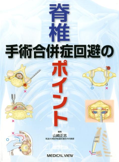 楽天ブックス: 脊椎手術合併症回避のポイント - 山崎正志