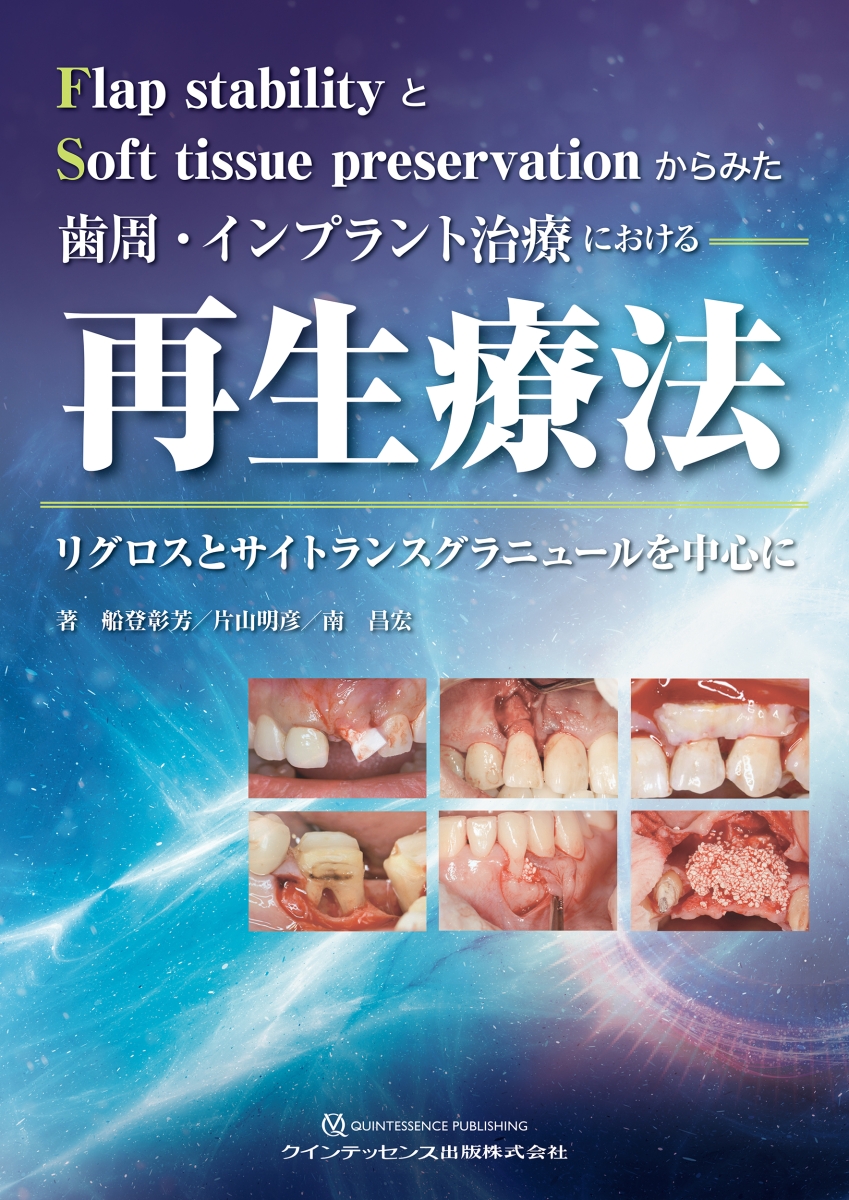 楽天ブックス: 歯周・インプラント治療における再生療法 - リグロスと