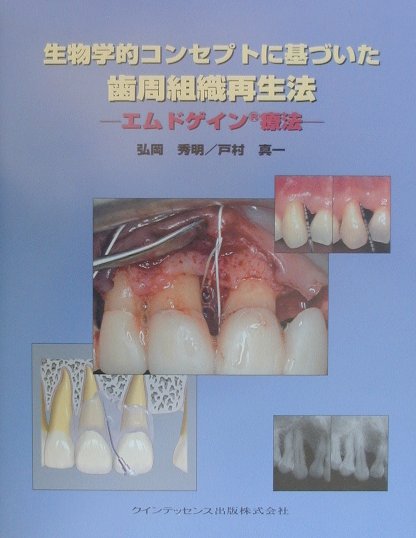 【美品】生物学的コンセプトに基づいた歯周組織再生法 エムドゲイン療法 楽天ブックス: 生物学的コンセプトに基づいた歯周組織再生法