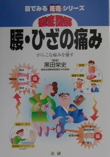 楽天ブックス: 徹底図解腰・ひざの痛み - がんこな痛みを癒す