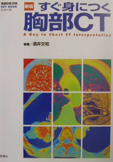 楽天ブックス: 新版すぐ身につく胸部CT - 酒井文和 - 9784879622501 : 本