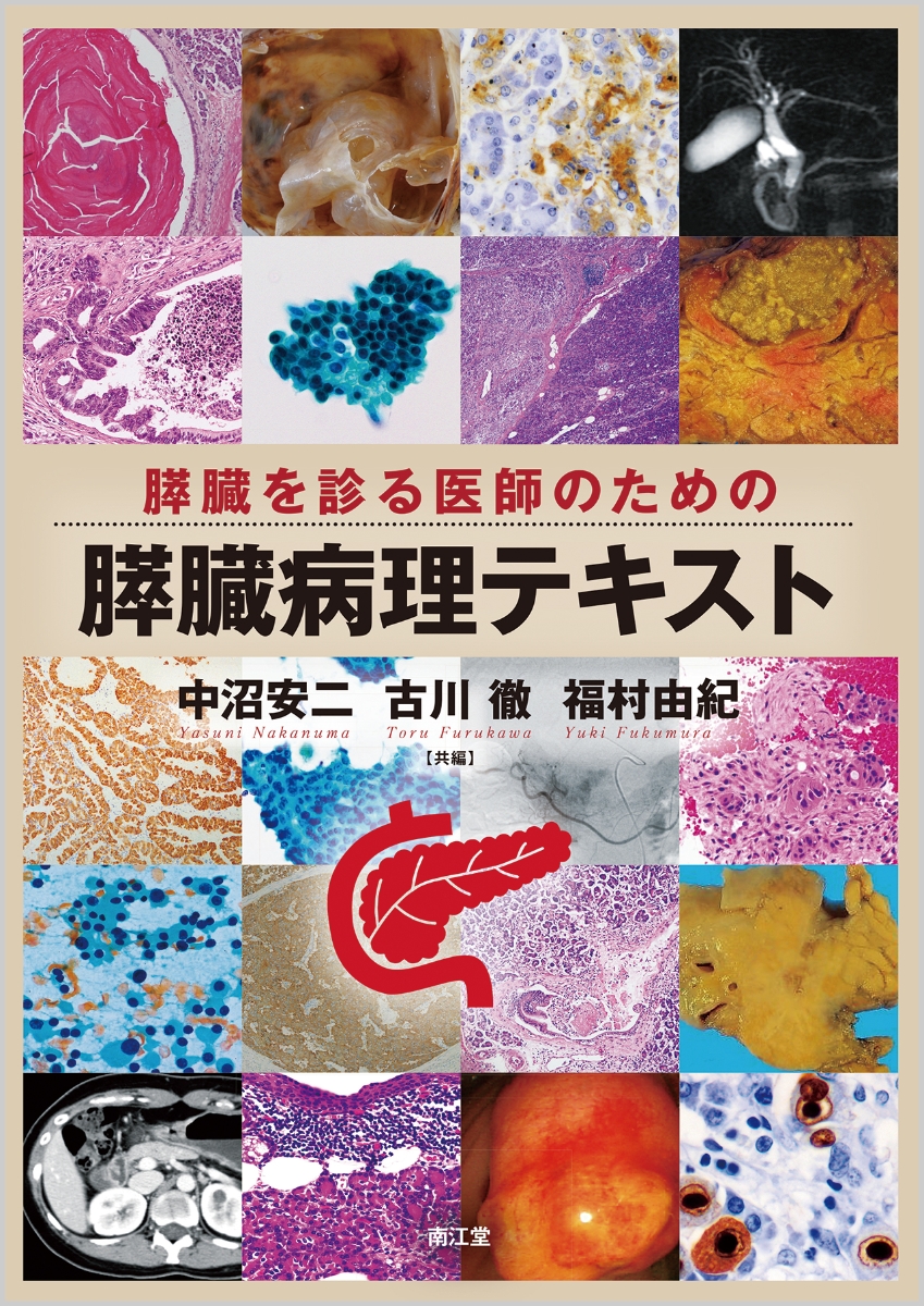 楽天ブックス: 膵臓を診る医師のための膵臓病理テキスト - 中沼 安二