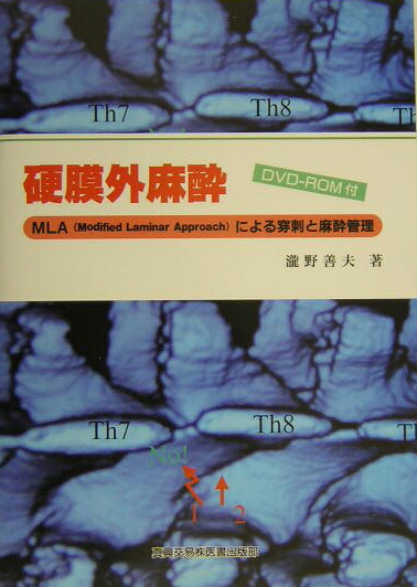 胸部硬膜外麻酔: ビジュアルに解説するMLA(modified laminar