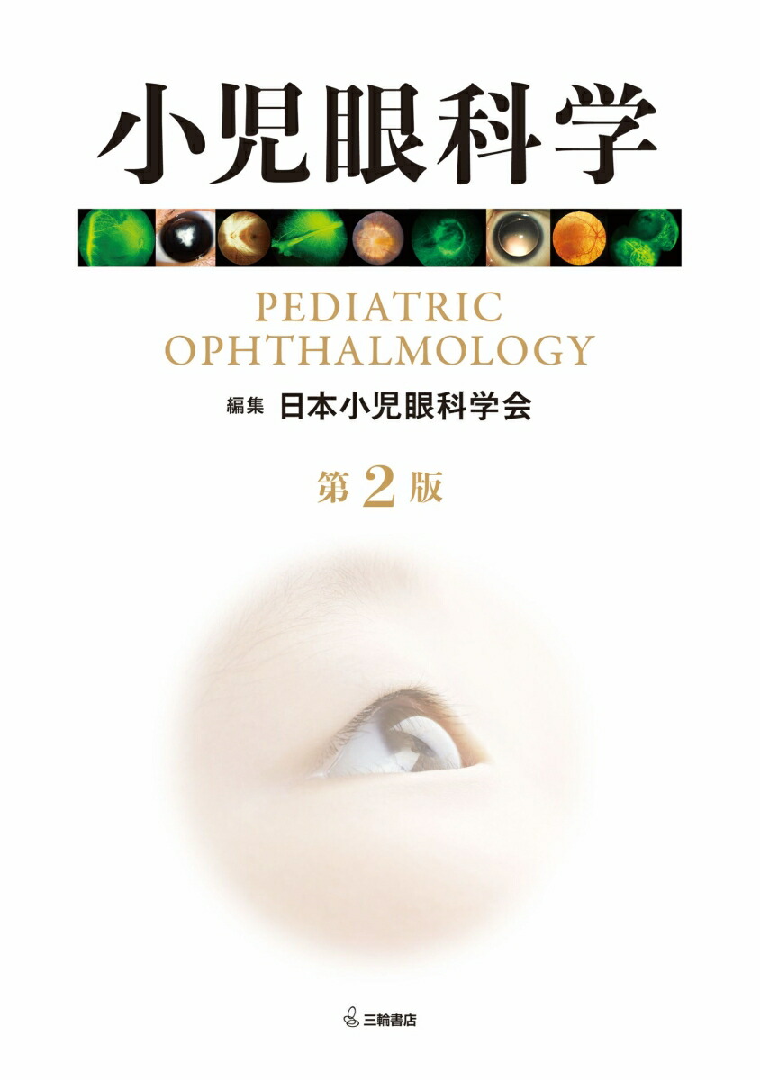 眼科学 第2版 2巻セット 楽天ブックス: 小児眼科学 第2版 - 日本小児眼科学会 - 9784895908801 : 本