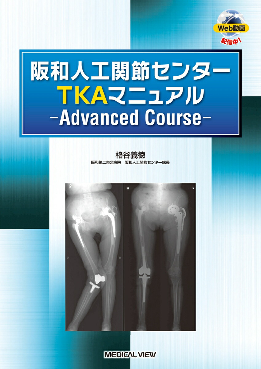 楽天市場】阪和人工関節センターTKAマニュアル Basic Course／格