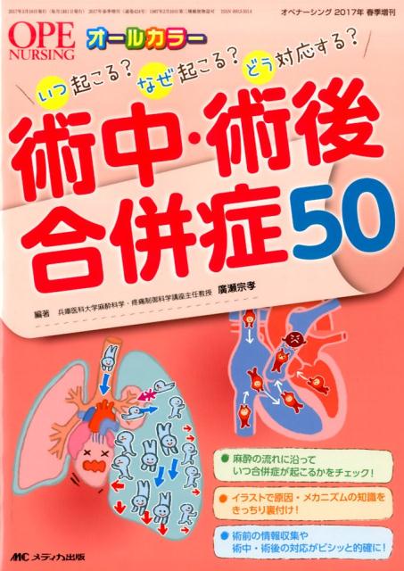 楽天ブックス: 術中・術後合併症50 - いつ起こる？なぜ起こる